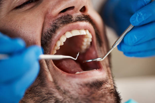 Best Tooth Pain Emergency Relief  in Monticello, AR